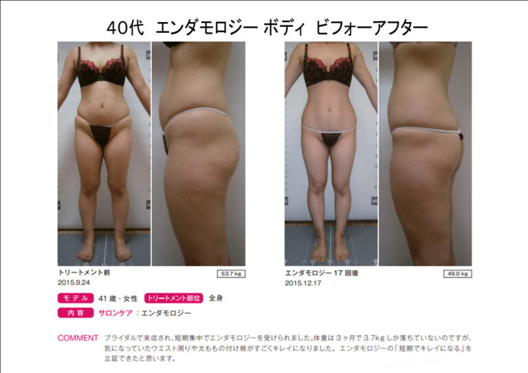 B41-15エンダbeforeafter