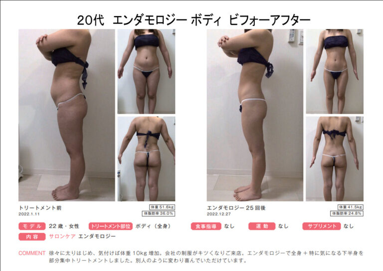 B22-22エンダbeforeafter