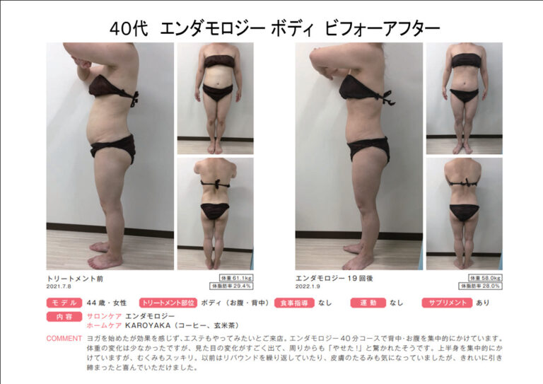B44-21エンダbeforeafter