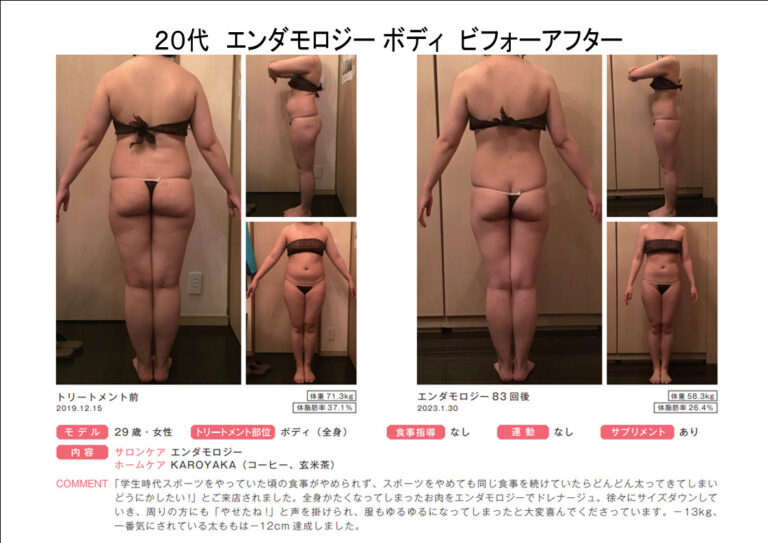 B29-1-23エンダbeforeafter
