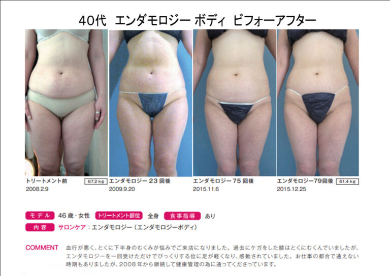 B46-15エンダbeforeafter