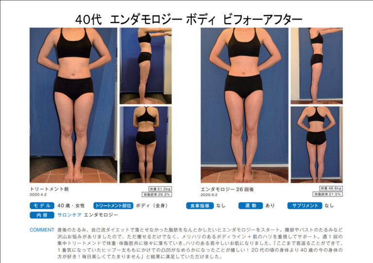 B40-20エンダbeforeafter