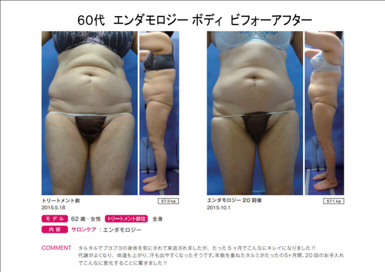 B62-15エンダbeforeafter