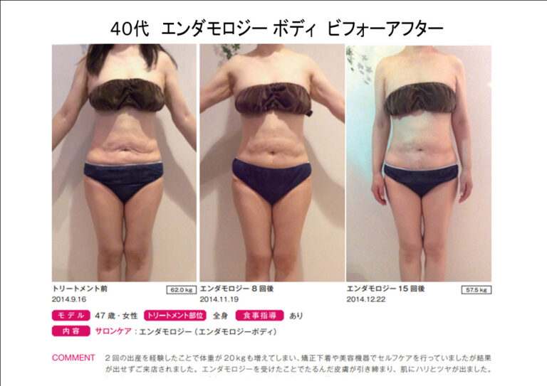 B47-14エンダbeforeafter