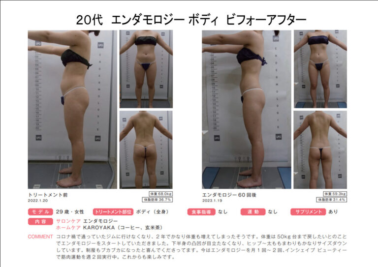 B29-2-23エンダbeforeafter